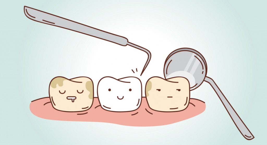 clipart tooth decay - photo #42